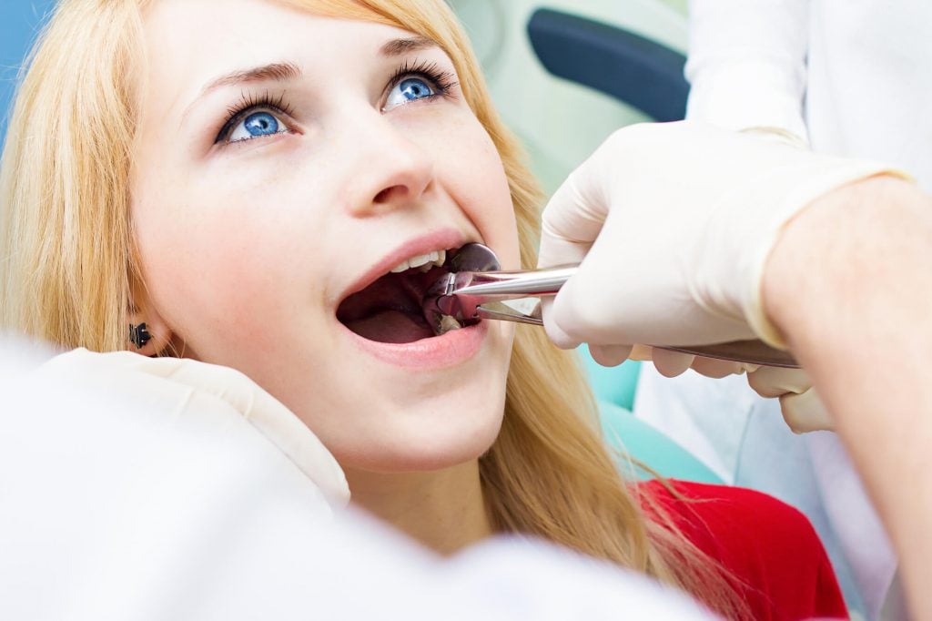 a woman needing tooth extractions in Simpsonville SC 