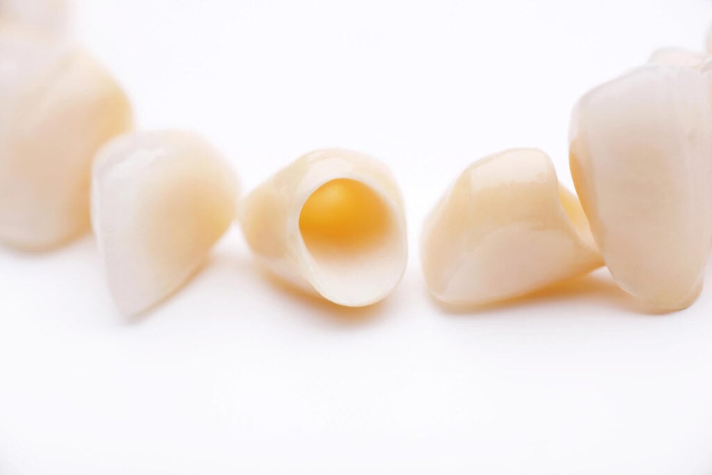 crowns in Simpsonville SC over white background